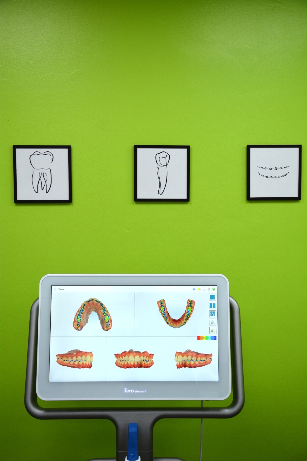 Orthodontie invisible Invisalign à Casablanca